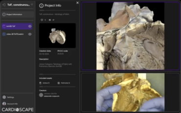 Cardioscape
